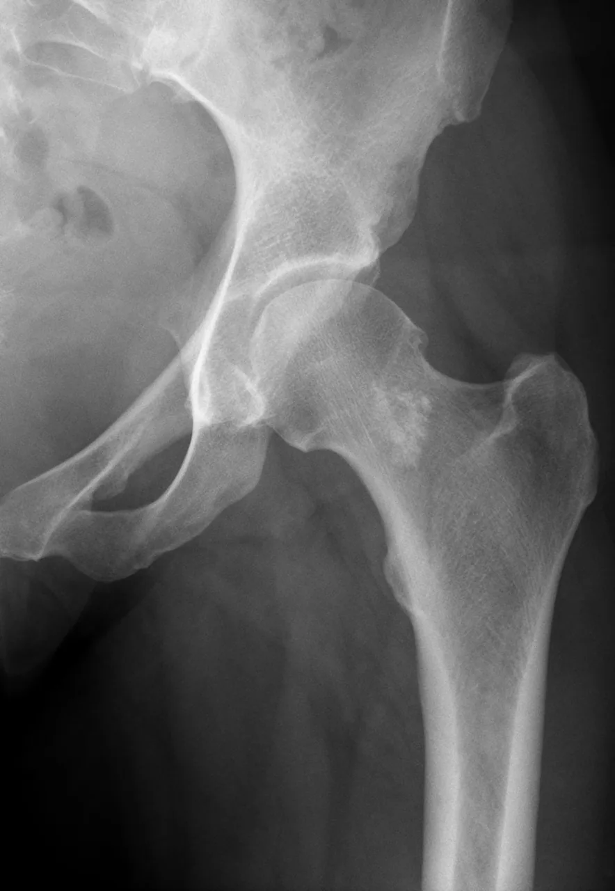 Bone & joint disease radiograph for self-assessment