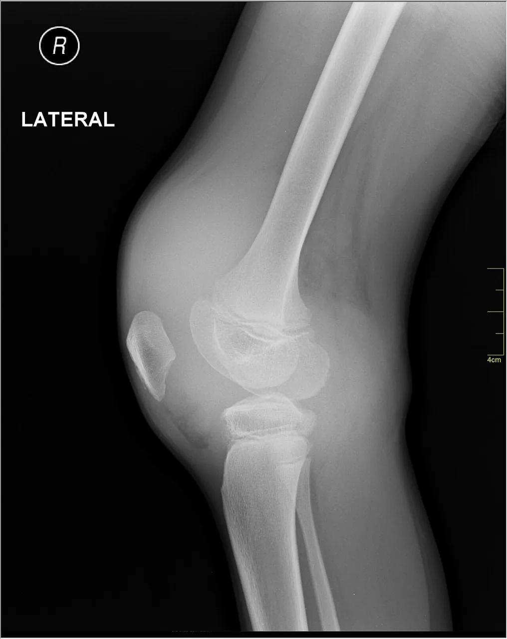 Lower limb radiograph for self-assessment