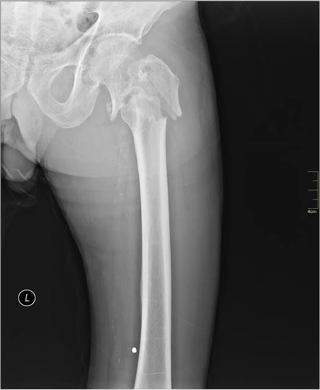 Lower limb radiograph for self-assessment