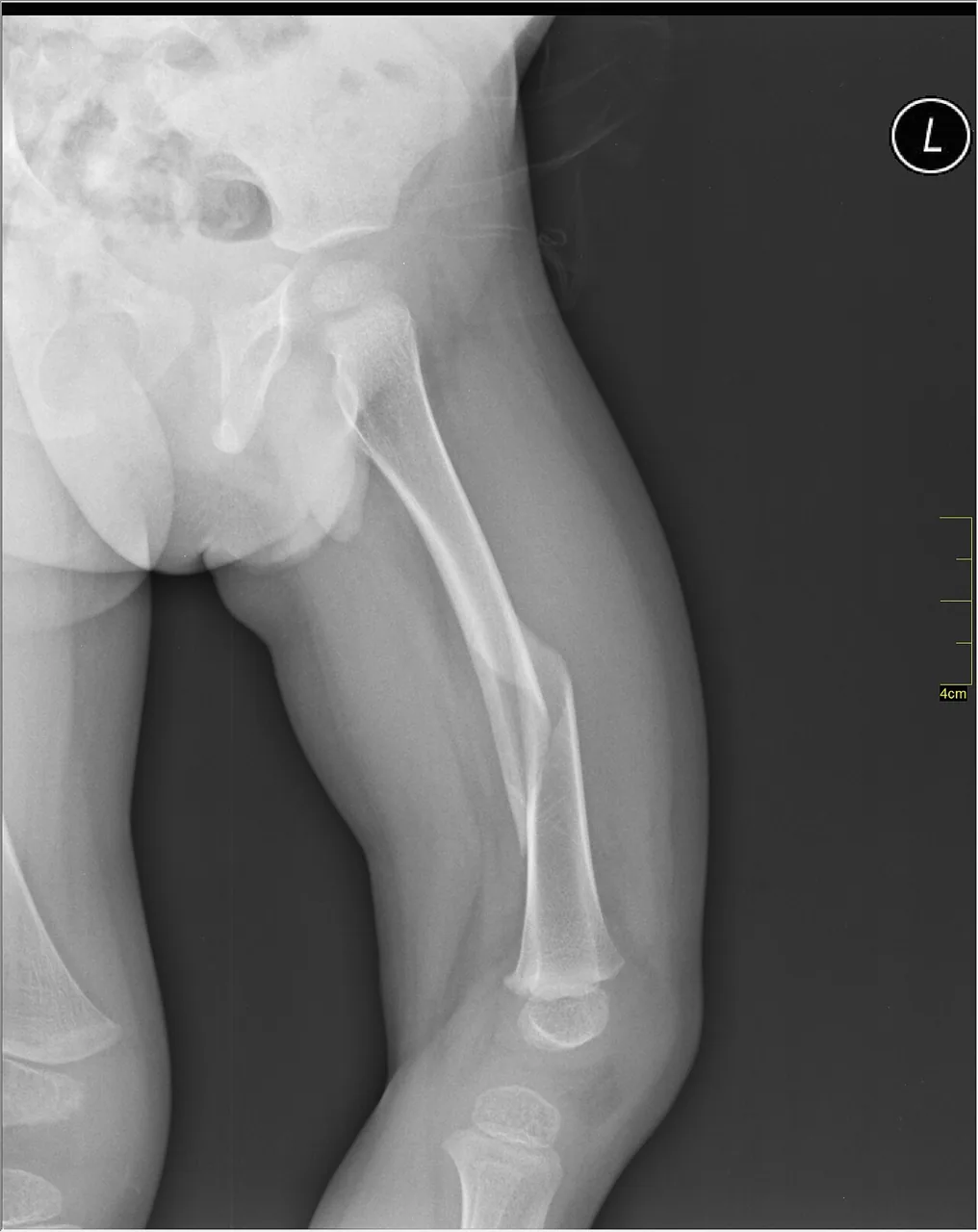 Lower limb radiograph for self-assessment