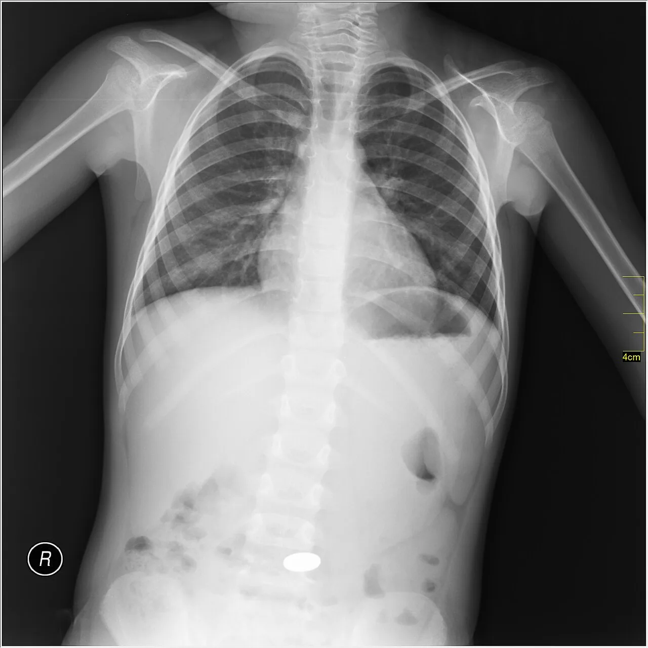 Abdomen radiograph for self-assessment