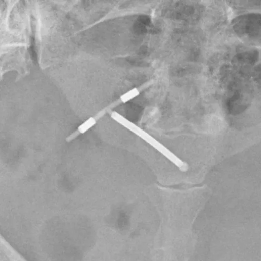 Abdomen radiograph for self-assessment