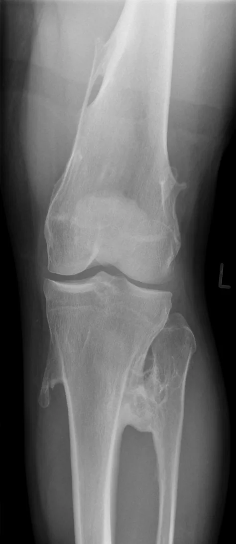 Bone & joint disease radiograph for self-assessment