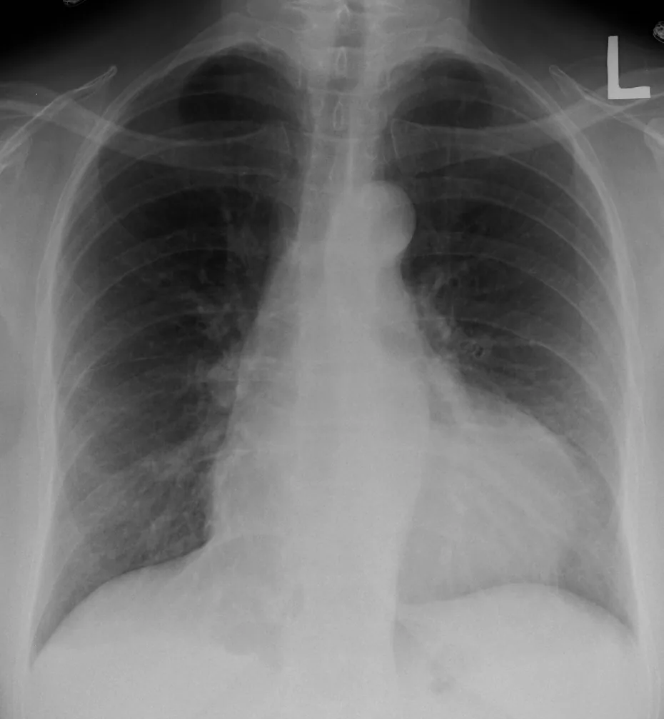 Chest radiograph for self-assessment
