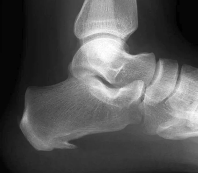 Lower limb radiograph for self-assessment