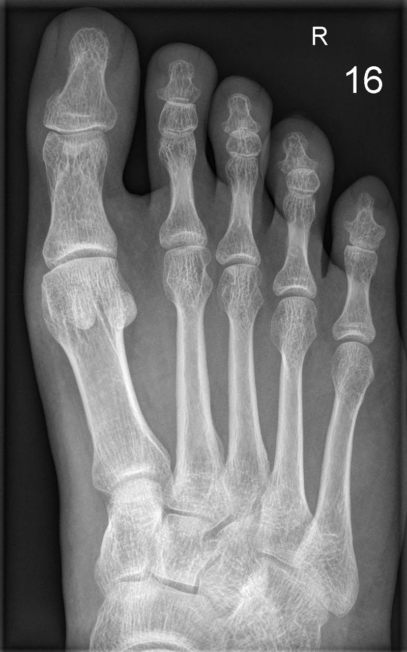 Lower limb radiograph for self-assessment