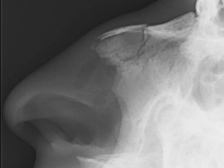 Skull & face radiograph for self-assessment
