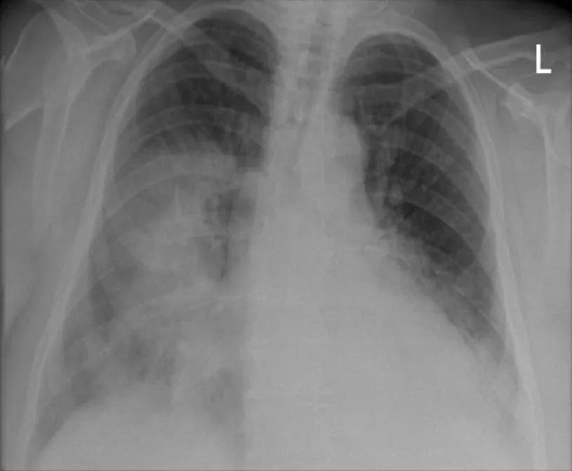 Chest radiograph for self-assessment