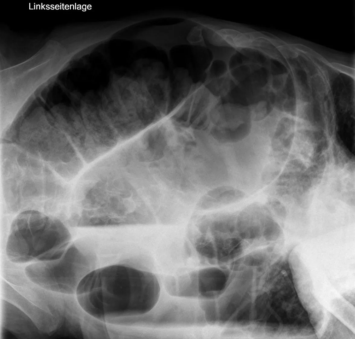 Abdomen radiograph for self-assessment