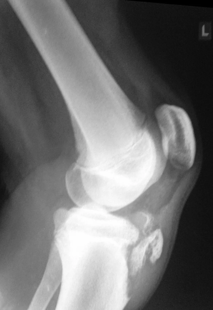 Lower limb radiograph for self-assessment