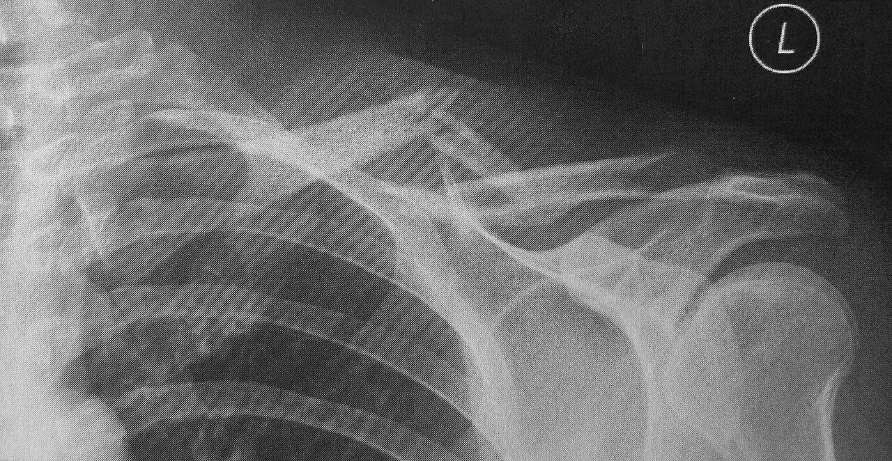 Upper limb radiograph for self-assessment
