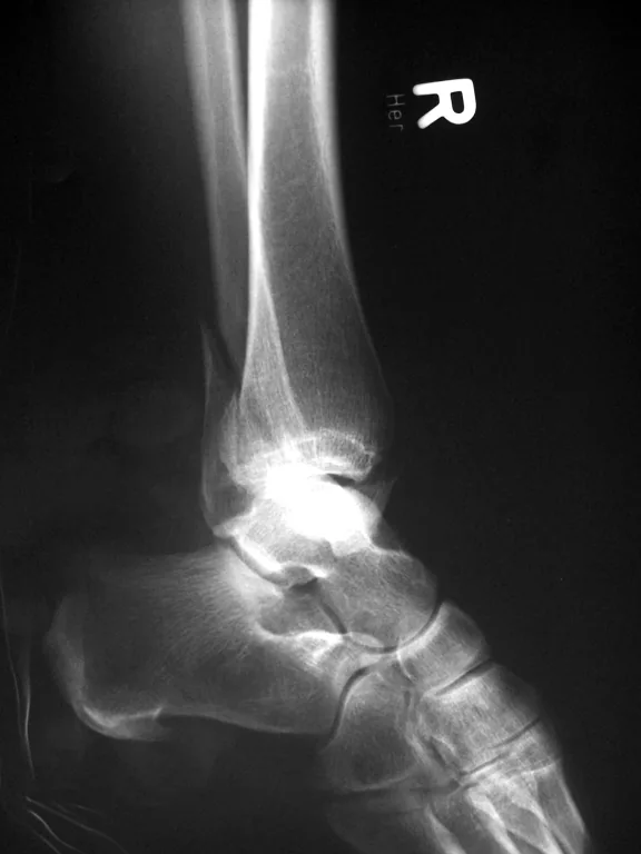 Lower limb radiograph for self-assessment