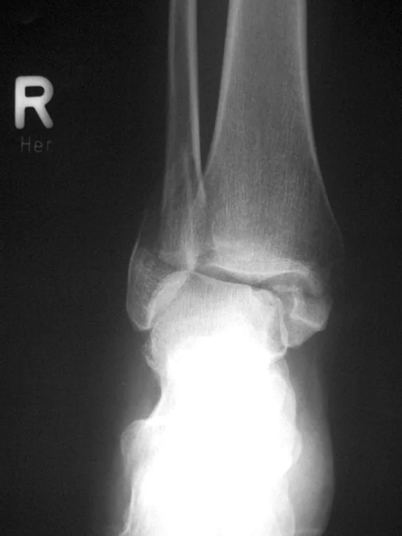 Lower limb radiograph for self-assessment