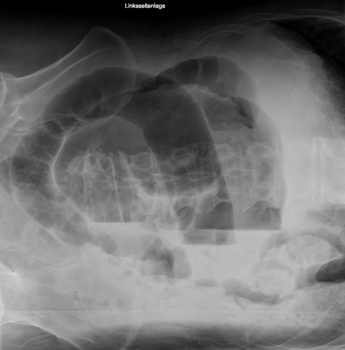 Abdomen radiograph for self-assessment
