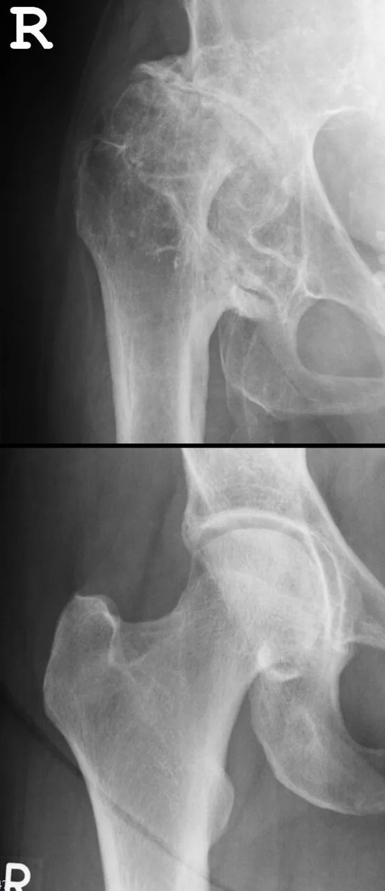 Paediatric radiograph for self-assessment