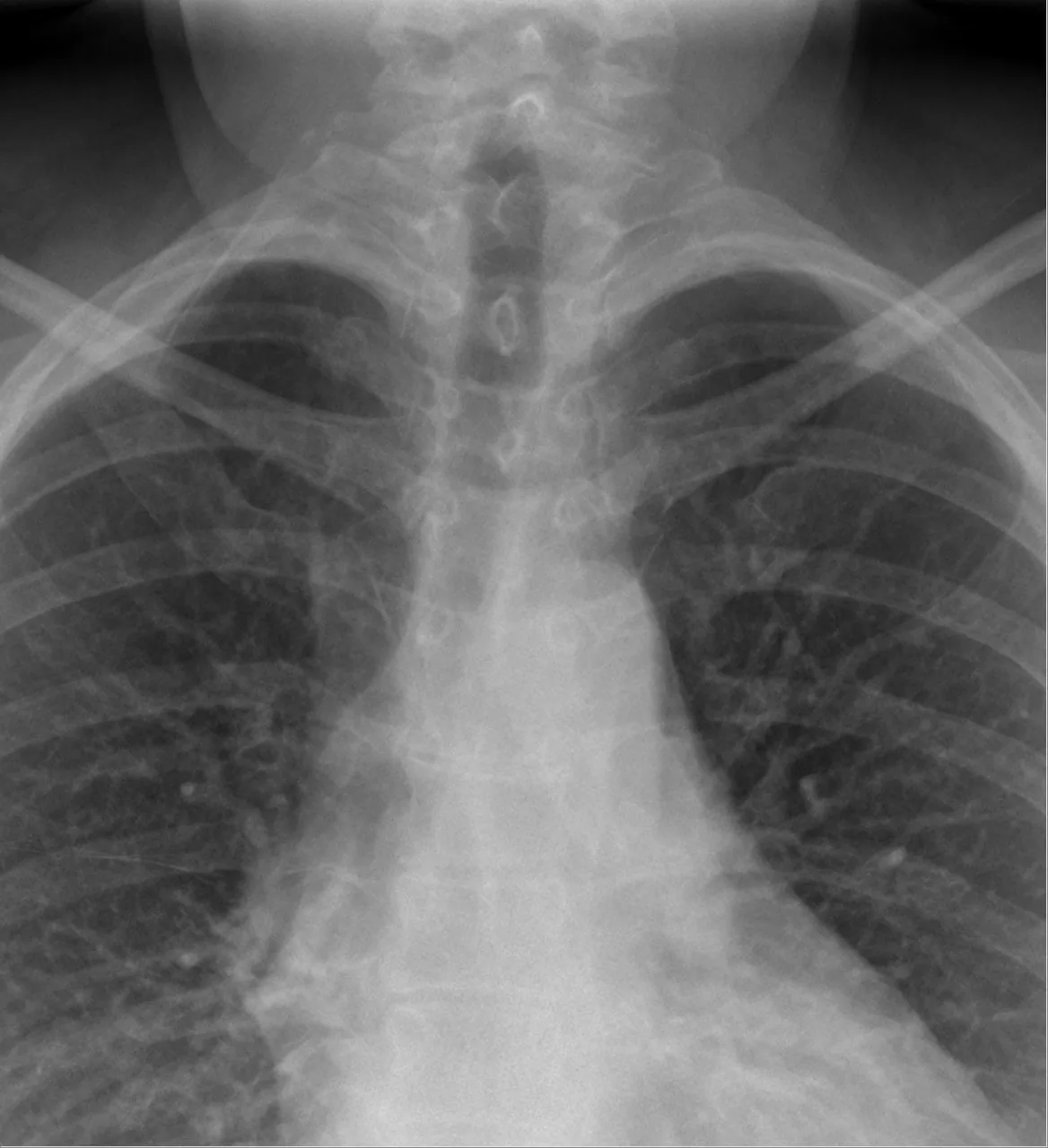 Chest radiograph for self-assessment