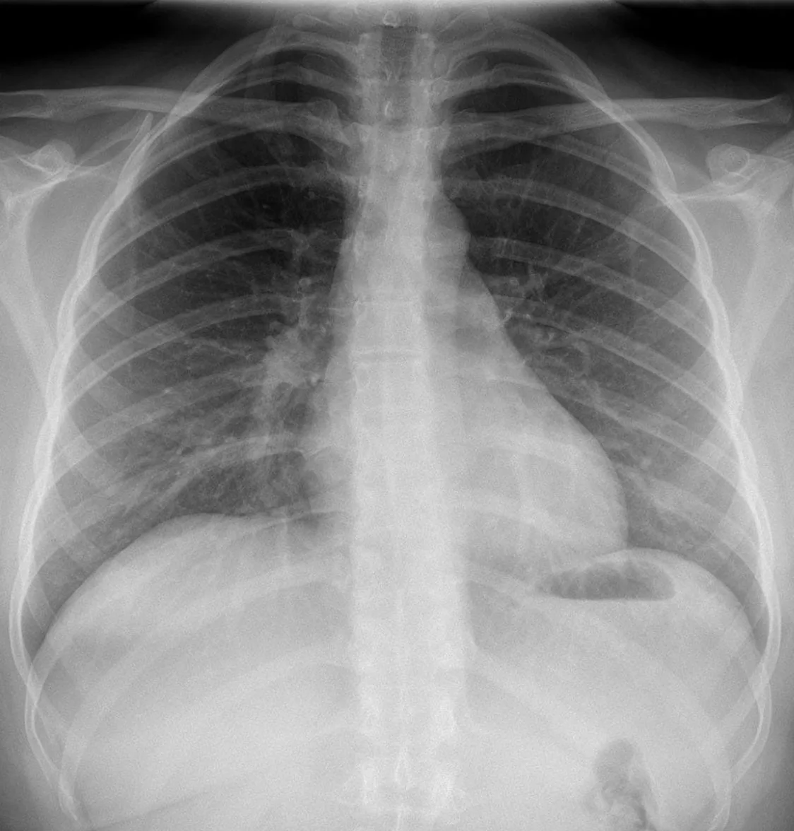Chest radiograph for self-assessment