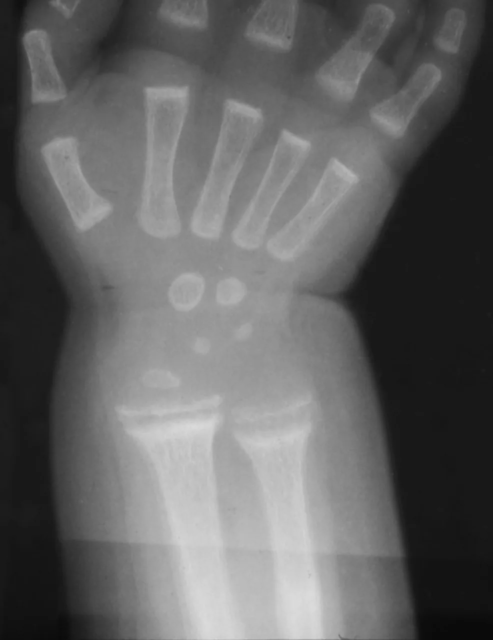 Paediatric radiograph for self-assessment