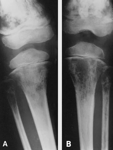 Bone & joint disease radiograph for self-assessment