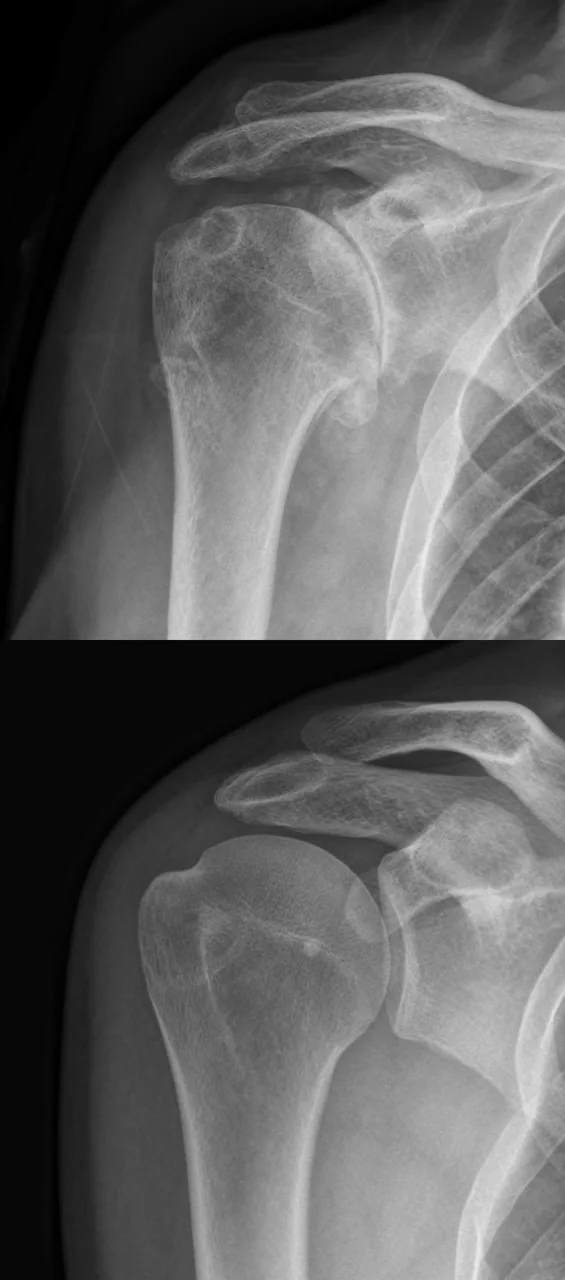 Bone & joint disease radiograph for self-assessment