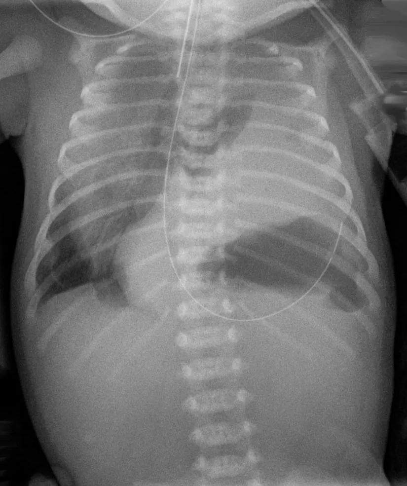Chest radiograph for self-assessment