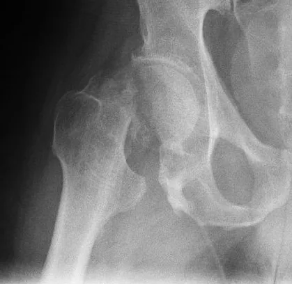 Lower limb radiograph for self-assessment