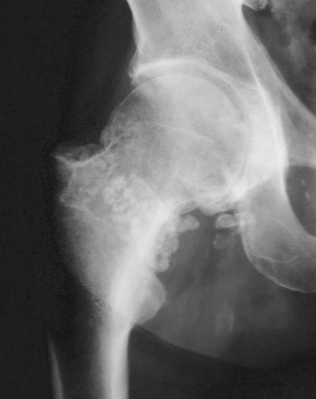 Bone & joint disease radiograph for self-assessment