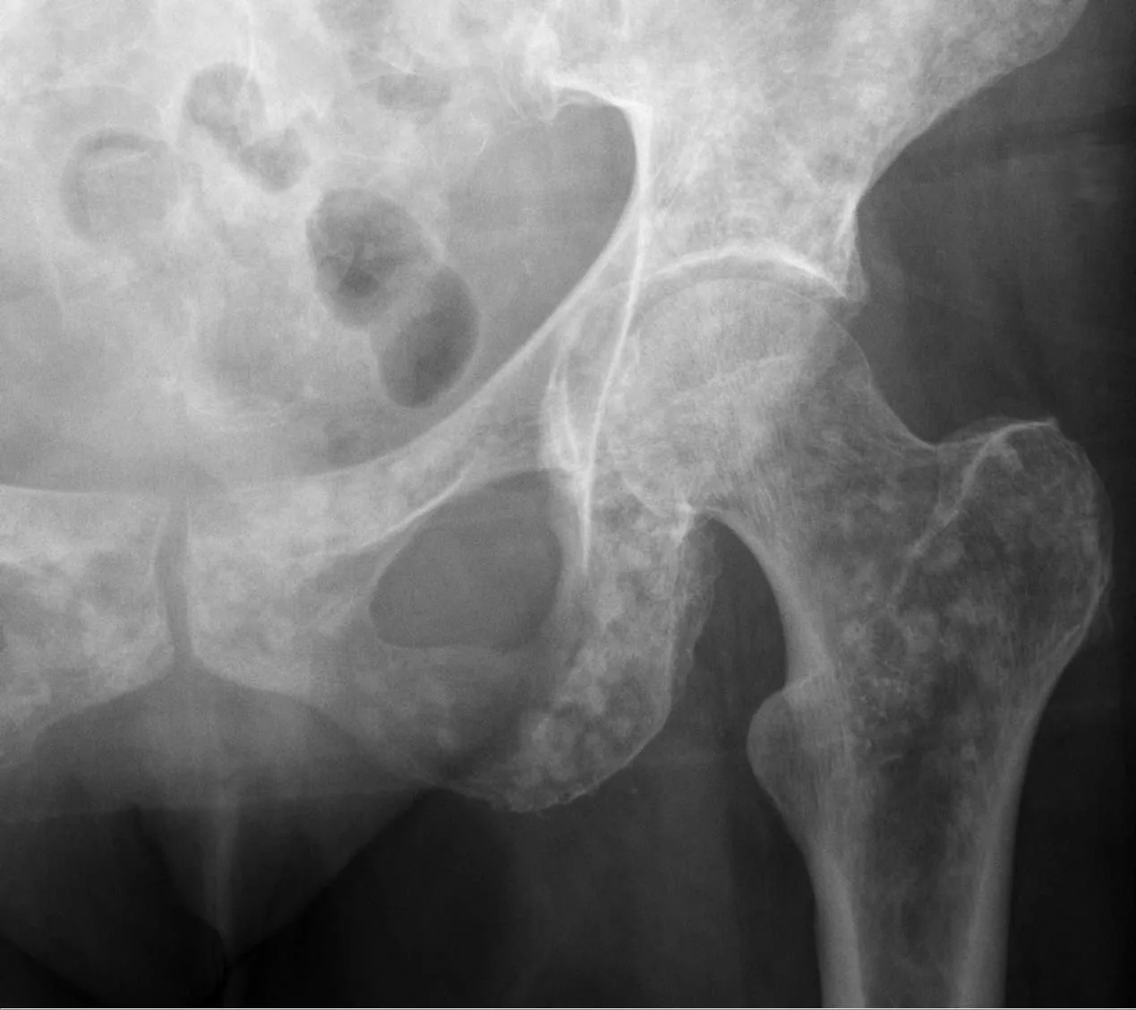 Bone & joint disease radiograph for self-assessment