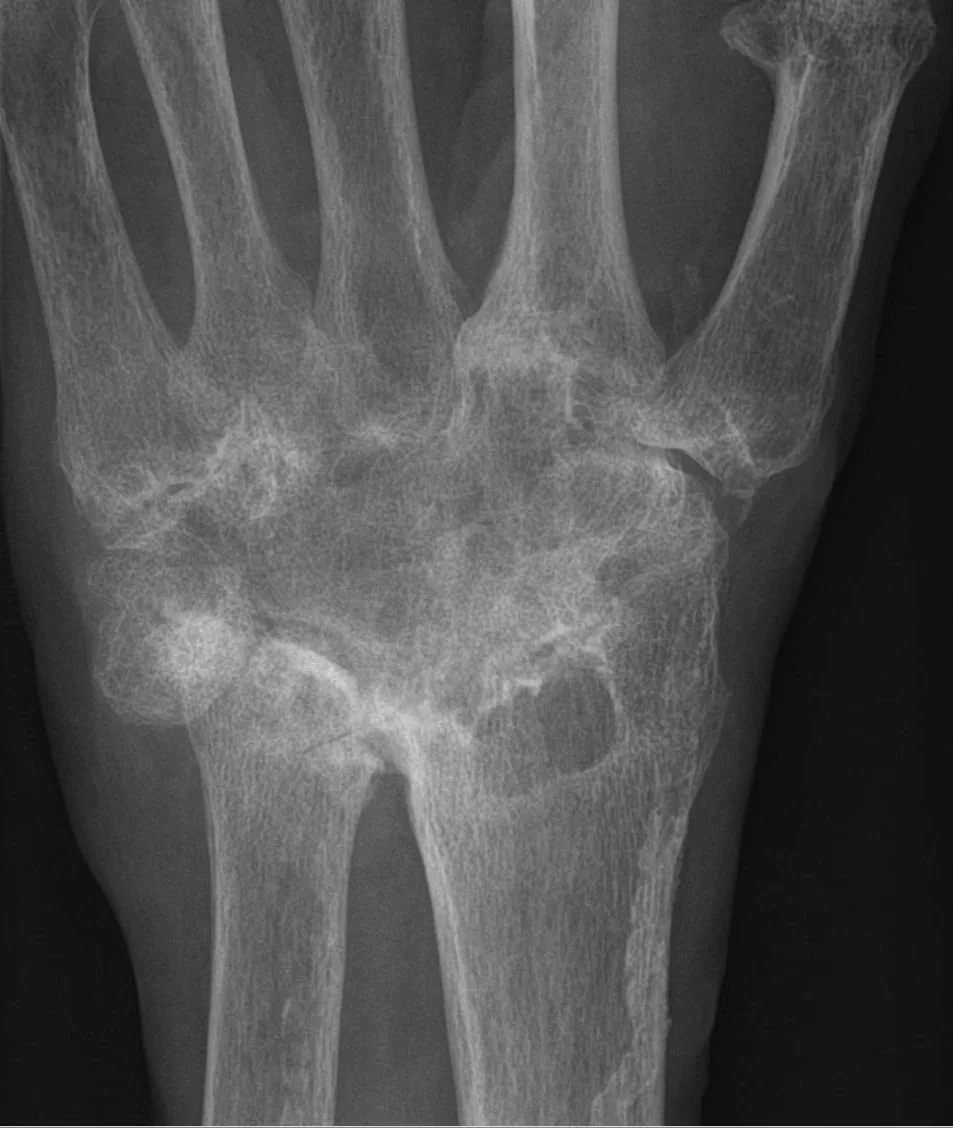 Bone & joint disease radiograph for self-assessment