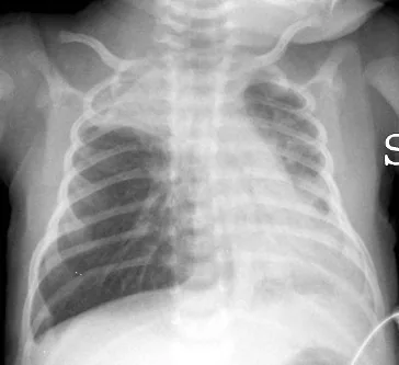 Chest radiograph for self-assessment