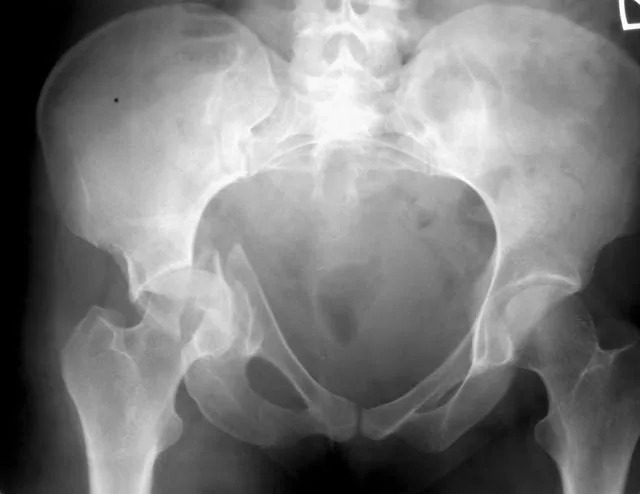 Lower limb radiograph for self-assessment
