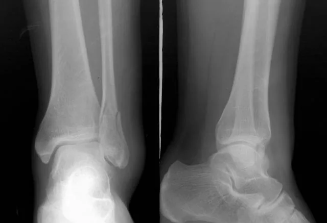 Lower limb radiograph for self-assessment