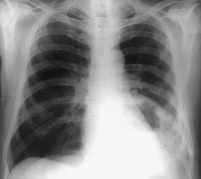 Chest radiograph for self-assessment
