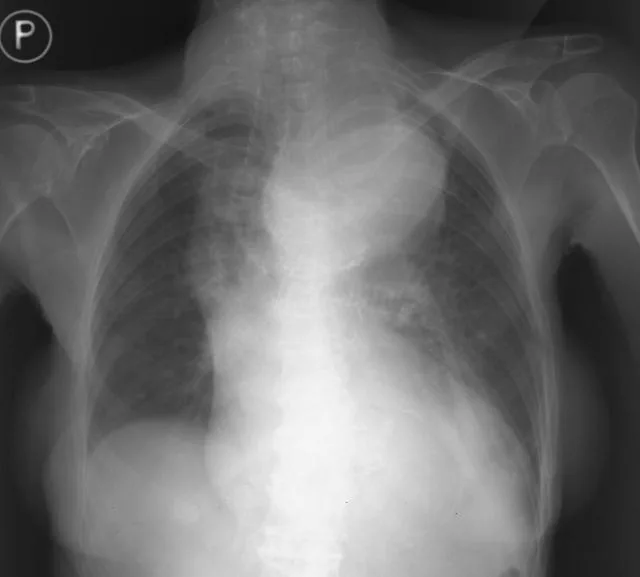 Chest radiograph for self-assessment
