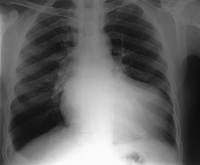 Chest radiograph for self-assessment