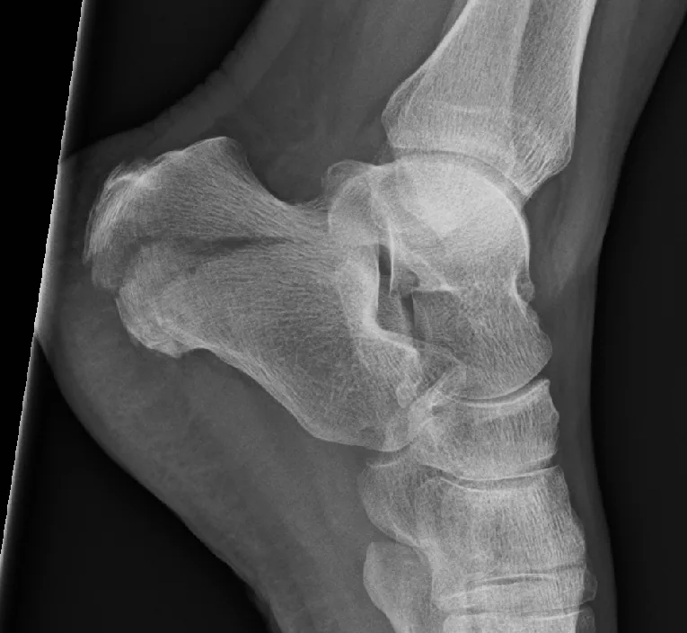 Lower limb radiograph for self-assessment