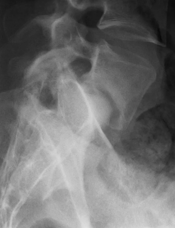 Spine radiograph for self-assessment