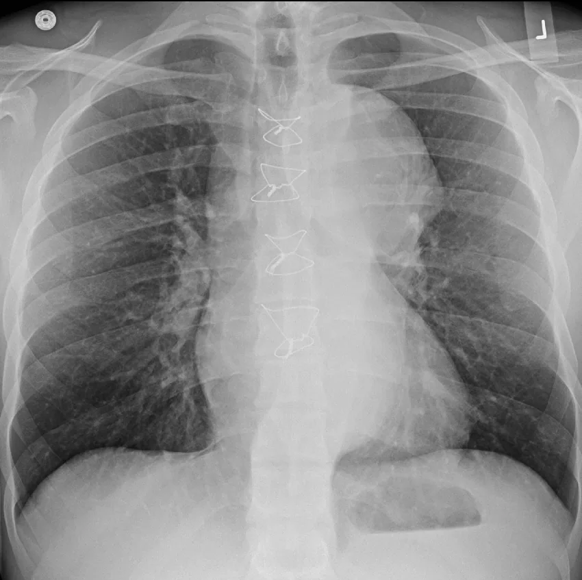 Chest radiograph for self-assessment