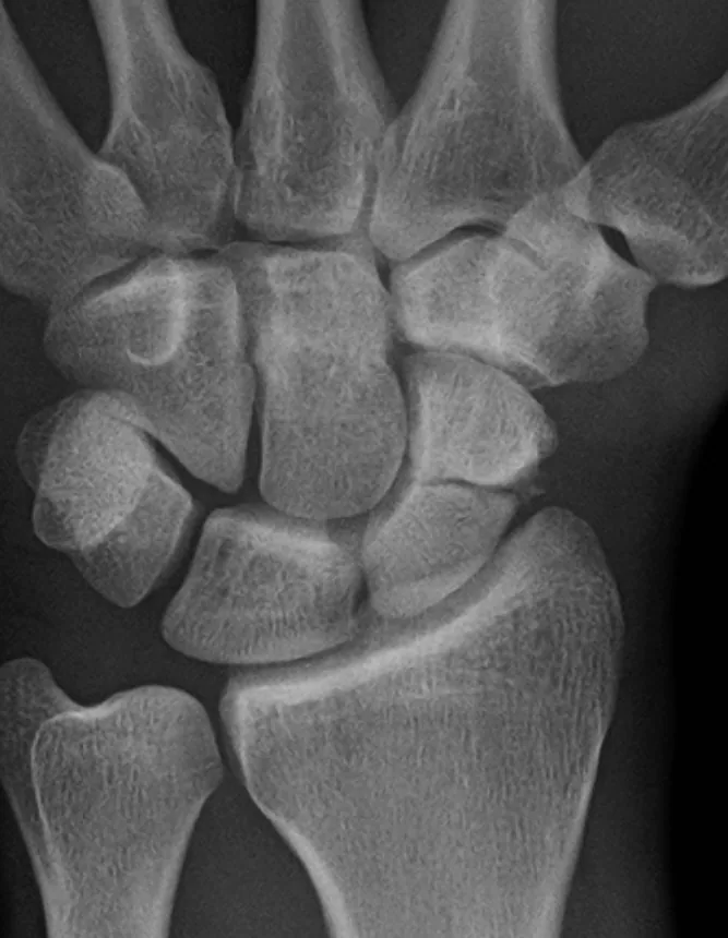 Upper limb radiograph for self-assessment