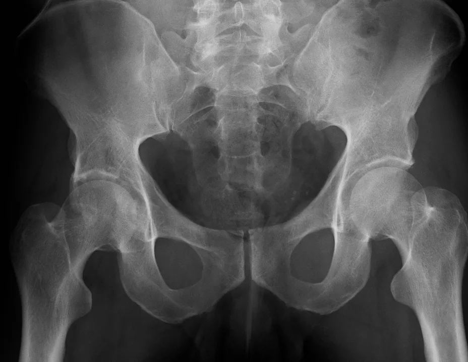 Lower limb radiograph for self-assessment