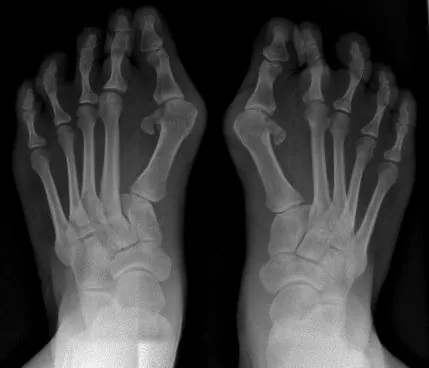 Bone & joint disease radiograph for self-assessment