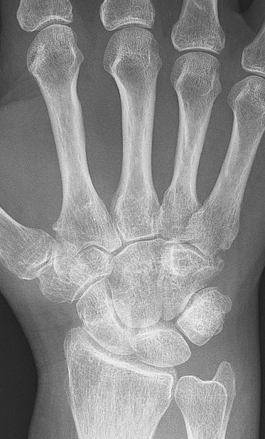 Bone & joint disease radiograph for self-assessment