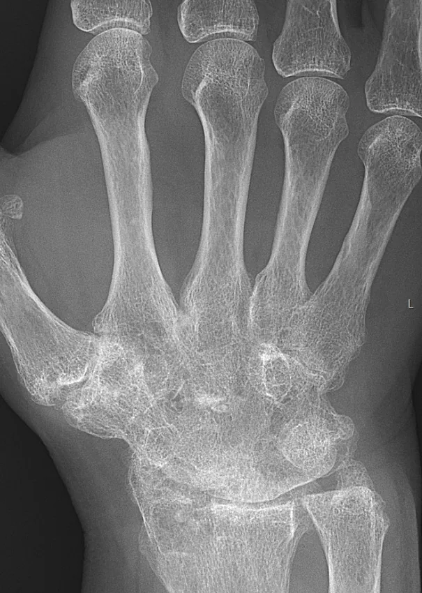 Bone & joint disease radiograph for self-assessment