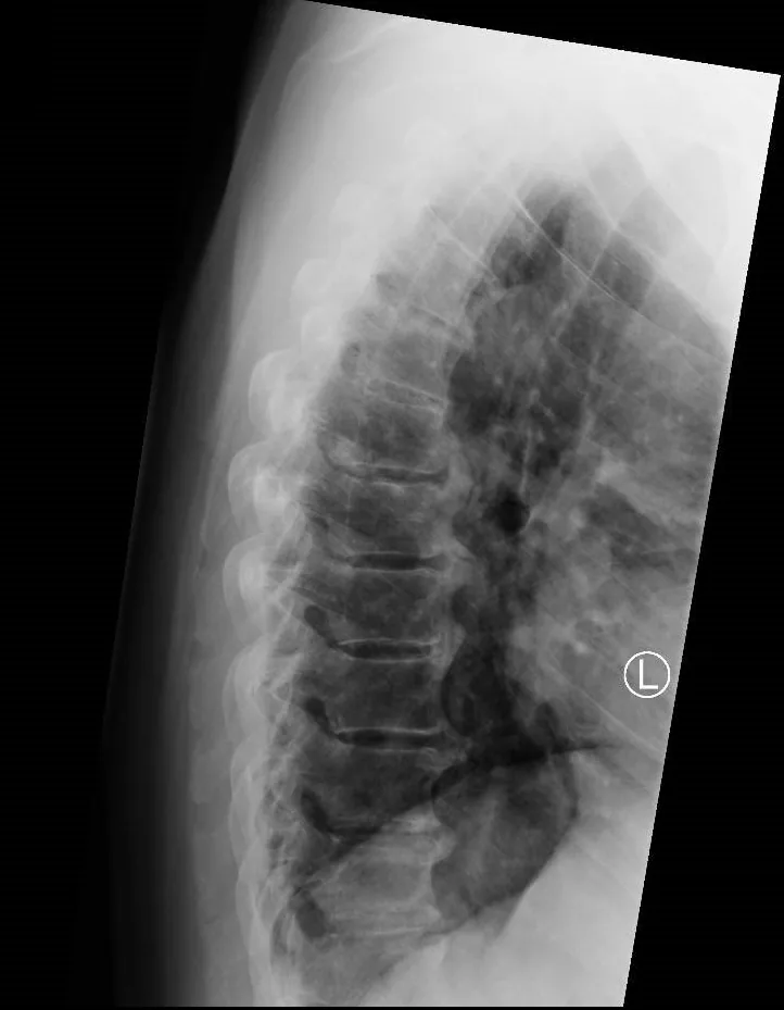 Spine radiograph for self-assessment