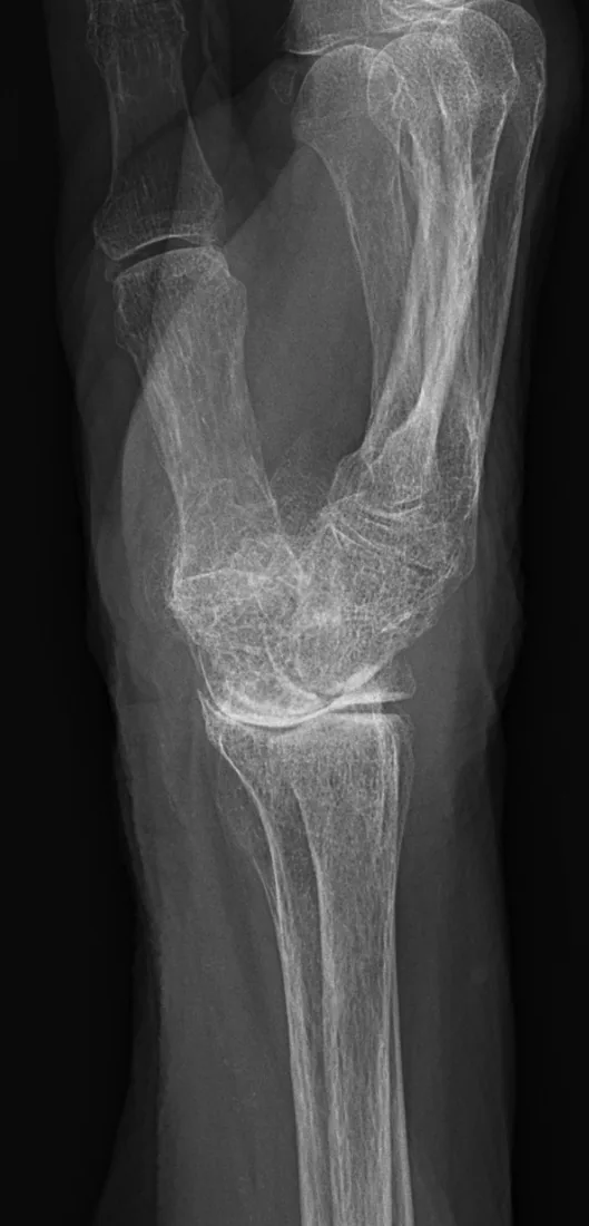 Bone & joint disease radiograph for self-assessment