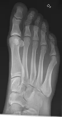 Radiograph from the case bank: Normal foot radiograph