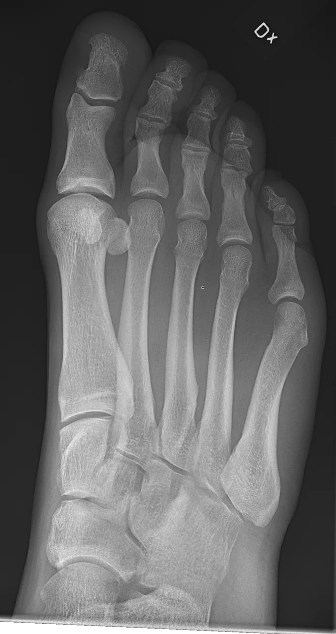 Lower limb radiograph for self-assessment