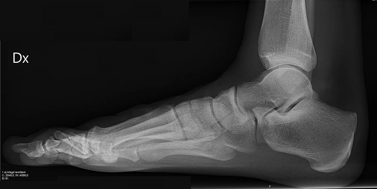 Lower limb radiograph for self-assessment