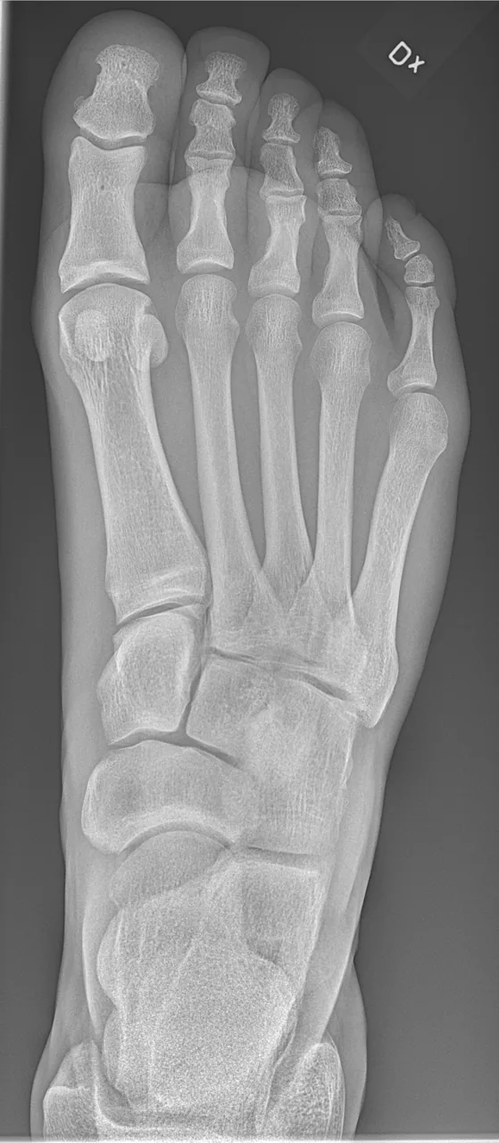 Lower limb radiograph for self-assessment