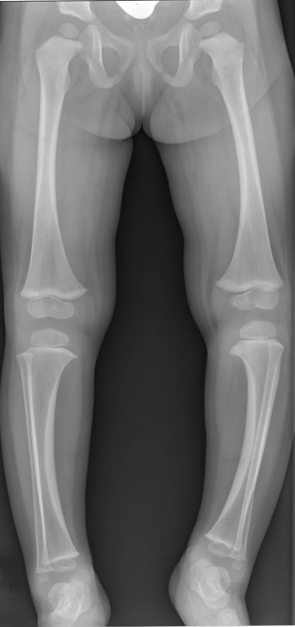 Paediatric radiograph for self-assessment